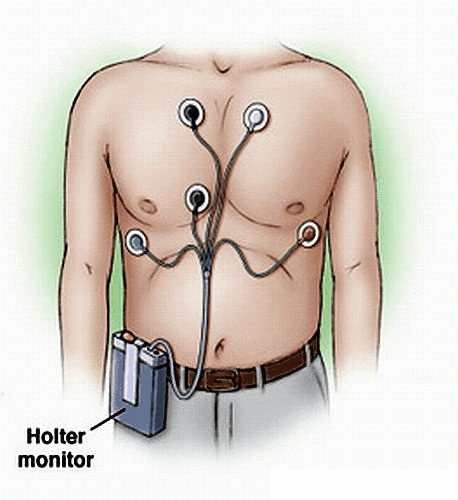 Holter Monitor